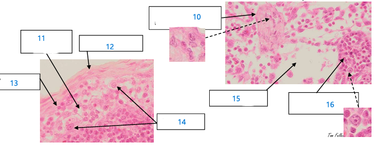 <p>12 Ganglions Lymphatiques</p>