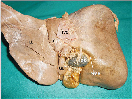 <p>Stores bile produced by the liver, releasing it into the small intestine to aid in the digestion of fats</p><p>Small, round</p>