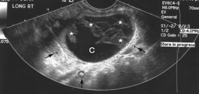 What is this an image of? And how do you know?