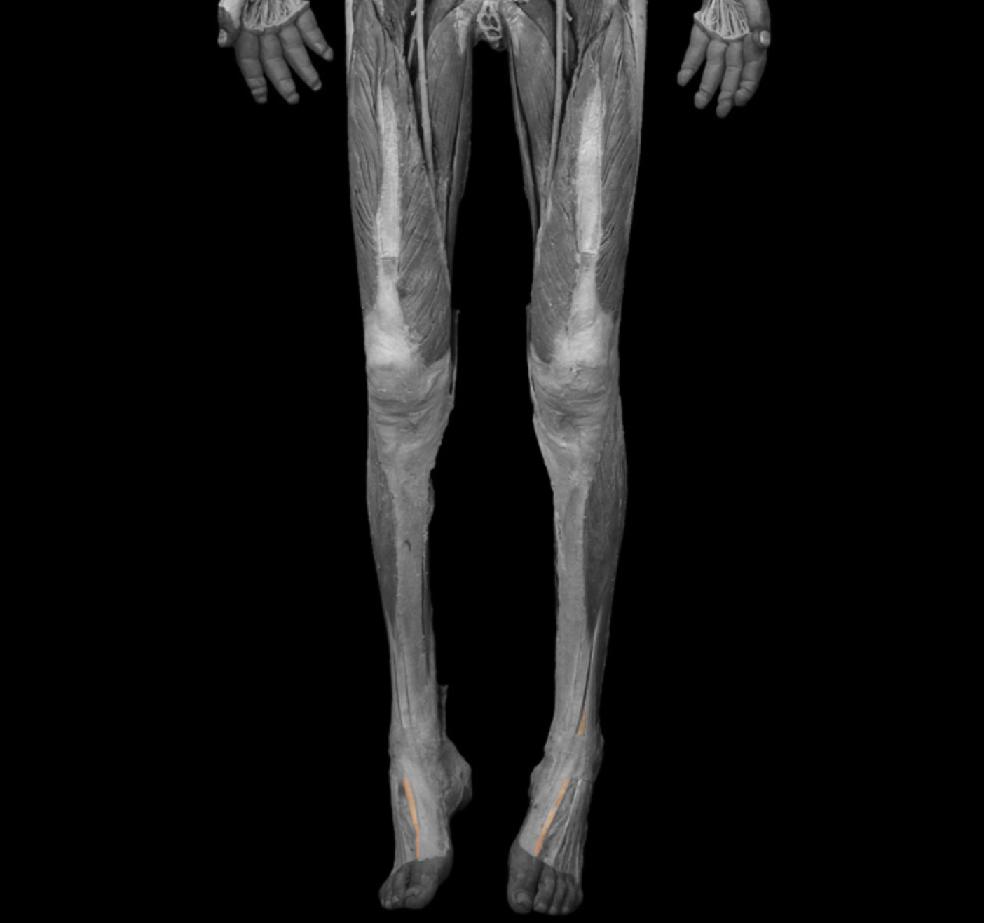 <p>origin: anterior surface of fibula, interosseous membrane </p><p></p><p>insertion: distal phalanx of hallux </p><p></p><p>action: dorsiflex foot at ankle, extend proximal phalanx of metatarsophalangeal joint </p><p></p><p>innervation: deep fibular (peroneal) nerve </p>