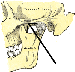 formed by the zygomatic and temporal processes fusing together