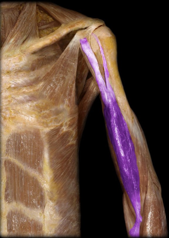 <p>Name the muscle highlighted (two words - all lowercase)</p>