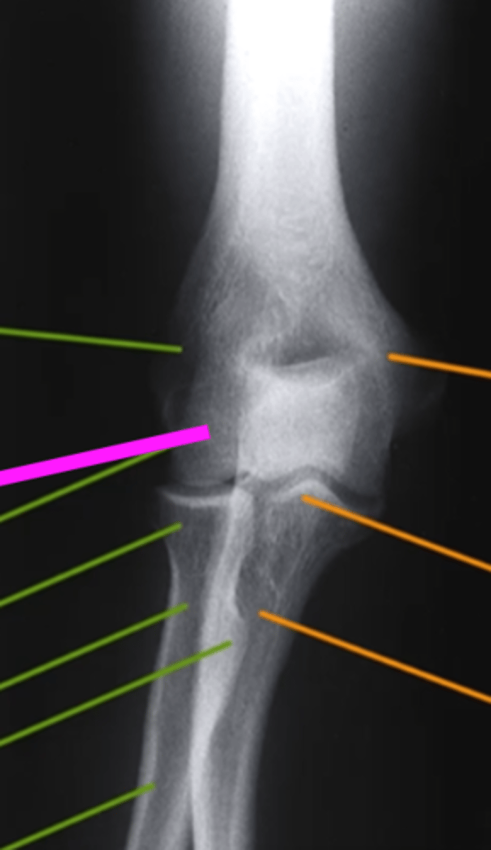 <p>what does the pink line point to?</p>