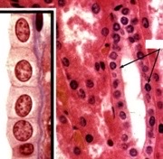 What type of epithelia? Where could it be located?