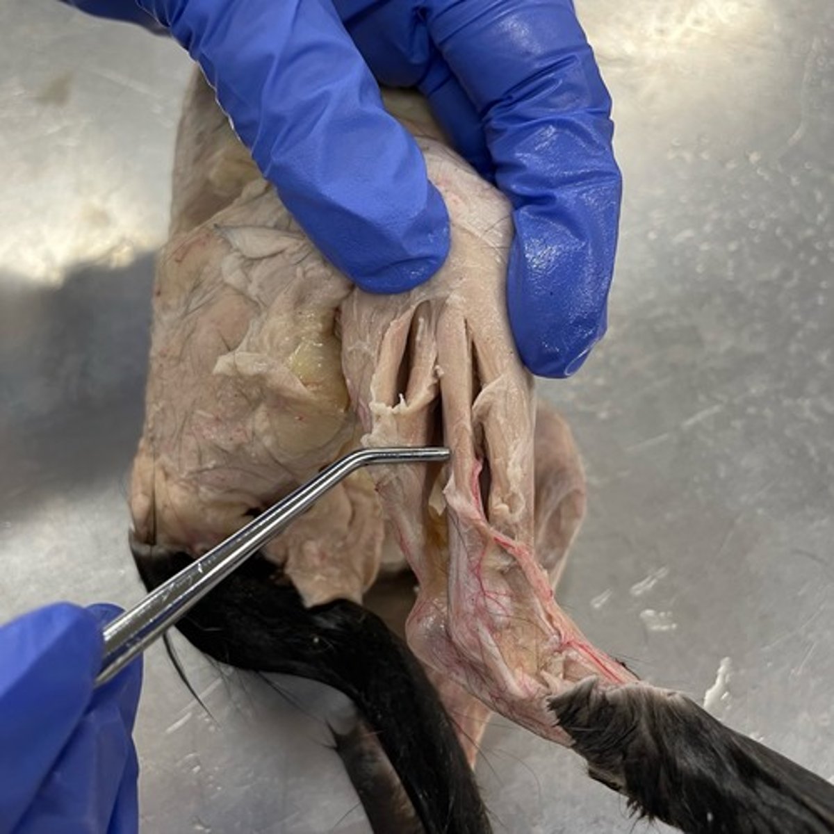 <p>O: fibula</p><p>I: metatarsal I</p><p>A: plantar flexion; ankle eversion</p>