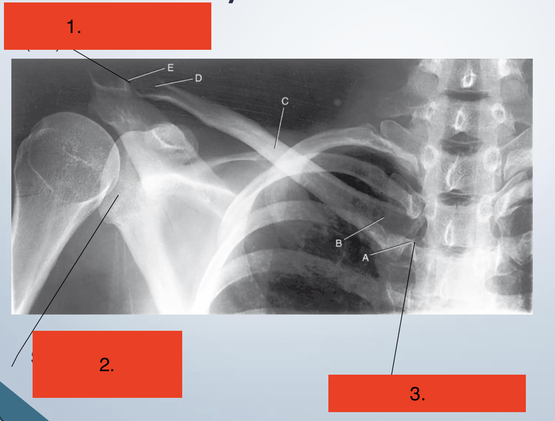 <p>Label the joints</p>