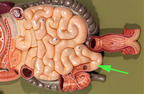 <p><span>The diffuse lymphatic tissue found in the structure marked by the green arrow is called peyer's <strong>PATCH</strong> </span></p>