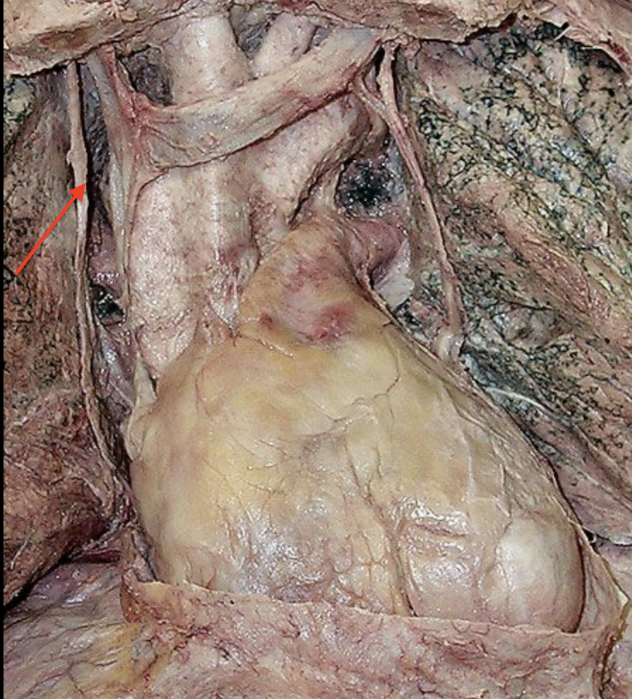 <p>What nerve is this</p>