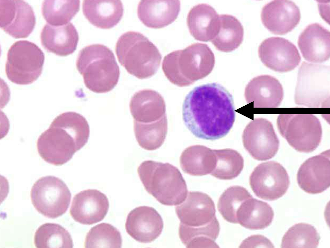 <p>What kind of blood cell is this?</p>