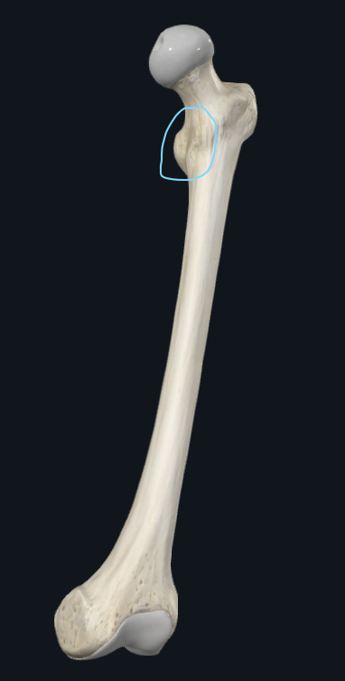 <p>What is this part of the femur called</p>