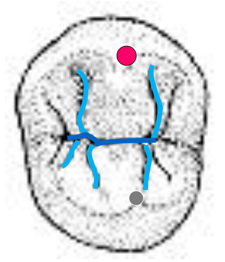<p>Name the tooth</p>