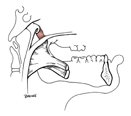 <p>Elevates palate</p>