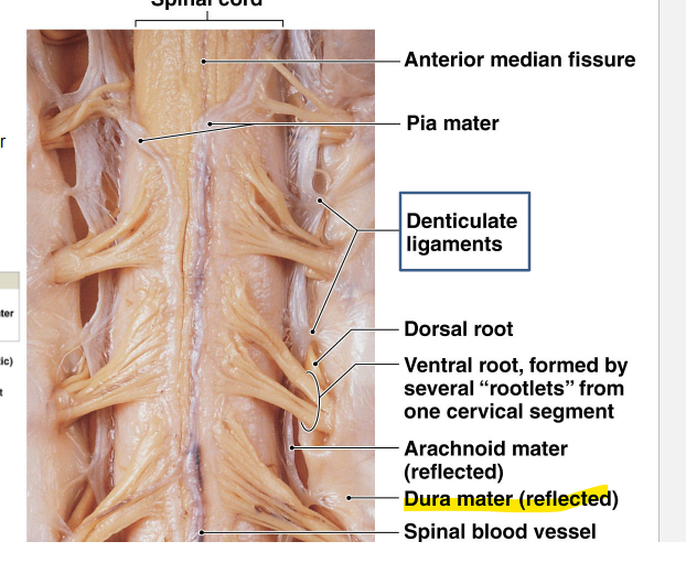 <p>attaches to the tectorial membrane and posterior longitudinal ligament </p><p>the space between the spinal dura matter and the periosteum of the vertebral column is called epidural space </p><p>filled with lose connective and adipose tissue traversed by anterior and posterior internal vertebral plexus </p>