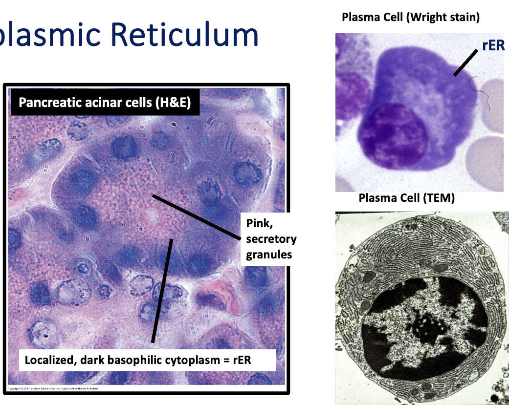 <p>blue (especially w/ Romanovsky stains)</p><ul><li><p><span>Romanovsky stains, such as Wright stain, include a basic dye (Methylene Blue) which binds to nucleic acids and their phosphate groups.&nbsp; These stains are very sensitive indicators of ribosomes and rER and almost all cell types will show some degree of cytoplasmic basophilia (i.e. some blue coloration) unless they are free of ribosomes and rER (e.g. mature erythrocytes).&nbsp;</span></p></li><li><p><span>Relatively quiescent cells will have pale blue cytoplasm, reflecting the low numbers of these organelles present.&nbsp; A really deep blue color reflects a large number of ribosomes, either free or associated with rER – indicating active protein synthesis.</span></p></li><li><p><span>Hematoxylin is not a true basic dye, so in sections stained with H&amp;E, the basophilia associated with ribosomes and rER is not as pronounced.</span></p></li></ul><p></p>