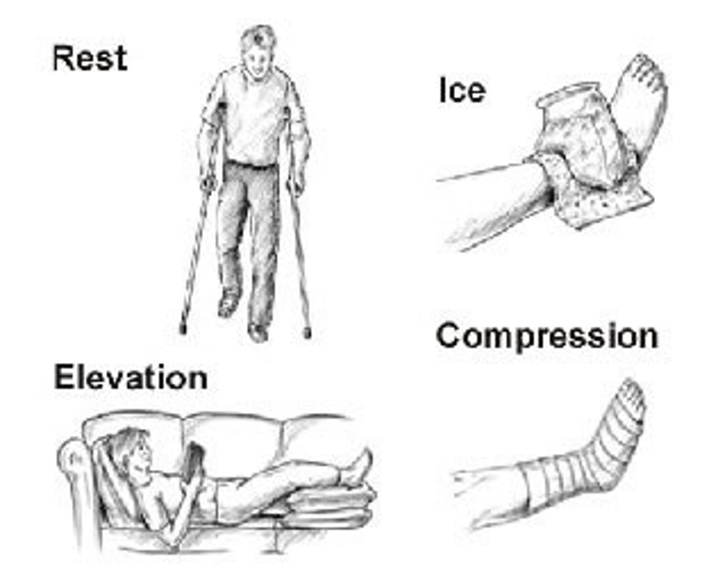 <p>treating injuries to bones, joints and muscles<br>1. Rest--don't use injured area<br>2. Ice--use ice pack to reduce swelling<br>3. Compression<br>4. Elevation</p>