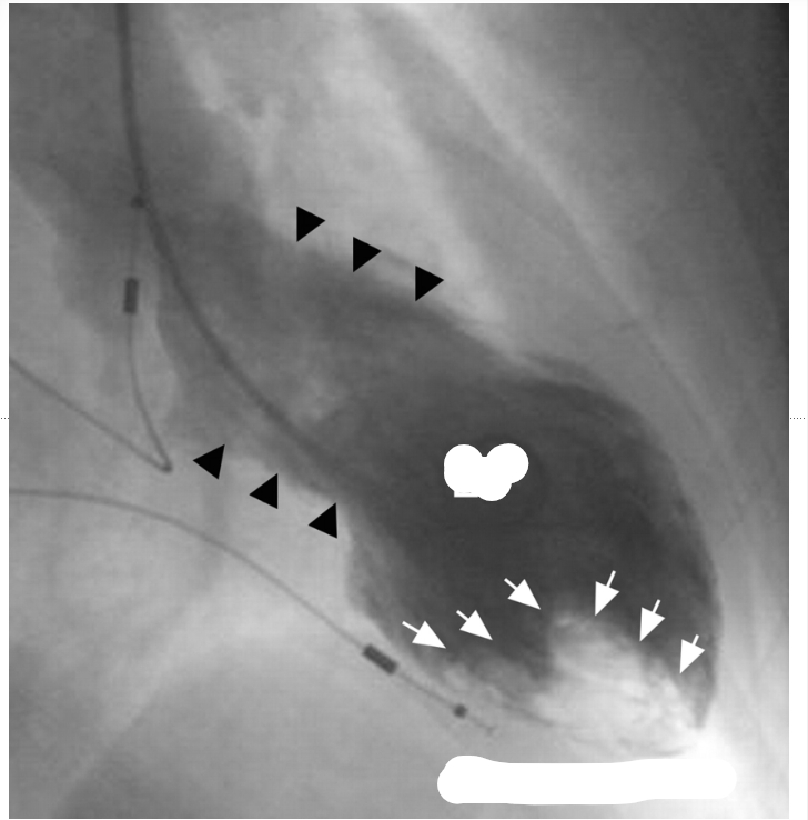 <p>what do you see in this vgram</p>