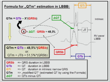 <p>How is QT measured in the setting of BBB</p>