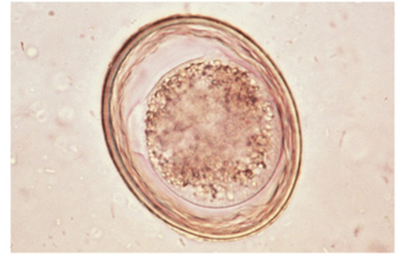 <p>This nematode ovum is seen in dogs and cats, with a hyaline central portion. This nematode is...</p>