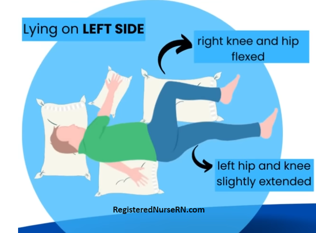 <p>Position in which a patient is lying on their left side with the left leg extended and the right leg bent at the hip toward the chest, left arm down at the side, and right arm bent in front of the body</p>