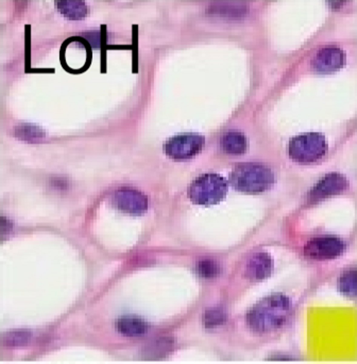 <p>thin tubules don't require ATP, water is just trying to diffuse out</p><p>-don't require mitochondrias as much</p><p>-squamous endothelium</p>