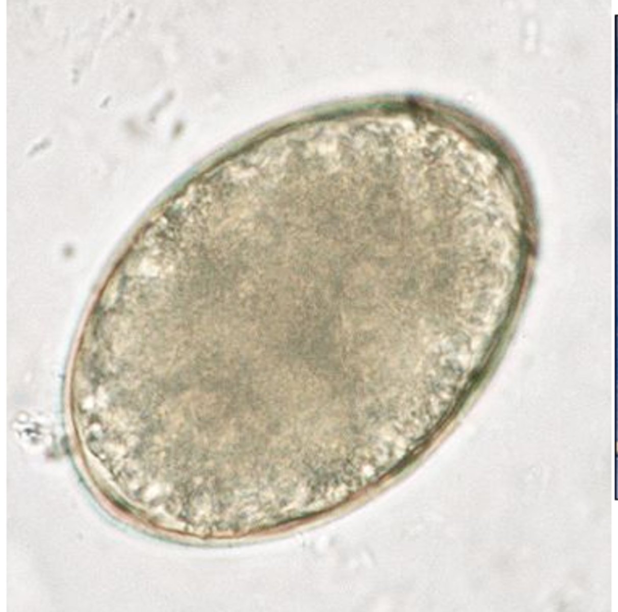 <p>What parasite is this if it is from a cat</p>