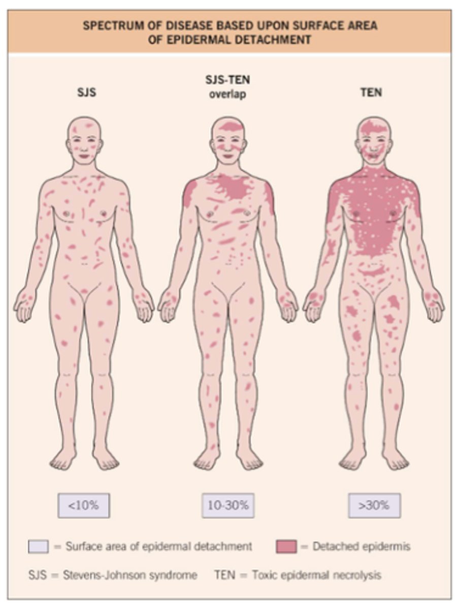 <p>Body surface area: TEN > SJS</p>
