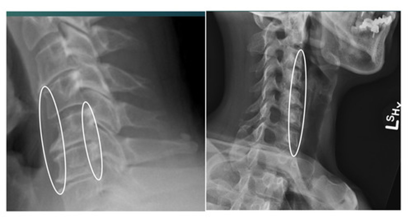 <p>What abnormality are we looking at?</p>