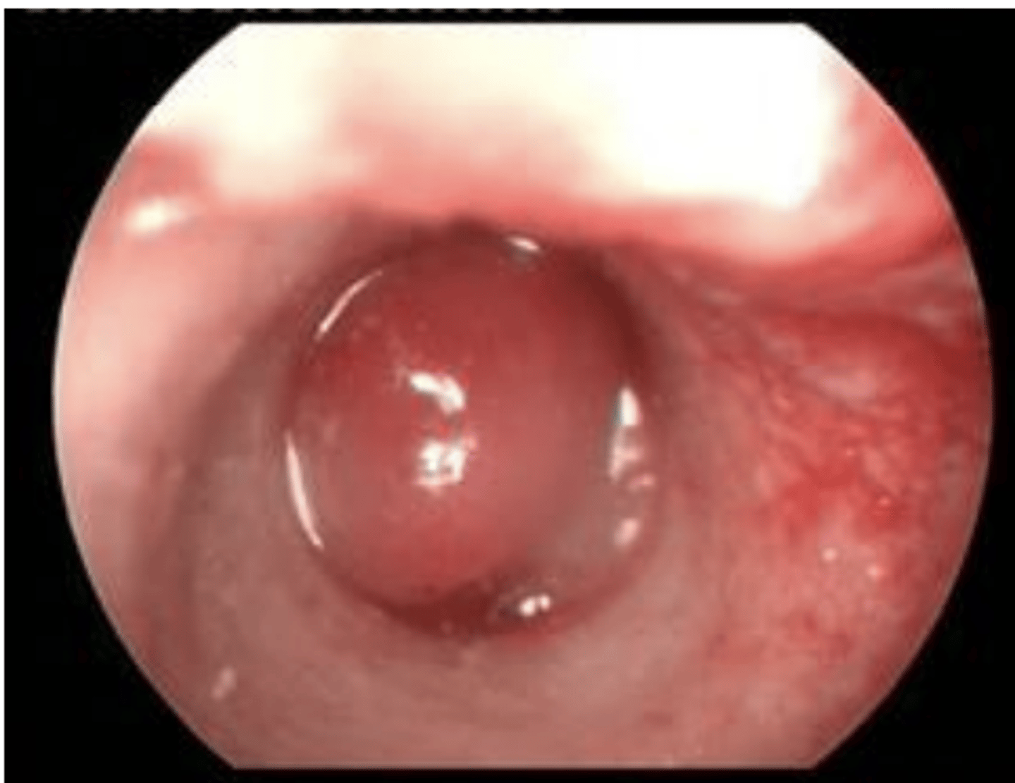 <p>What are the differential diagnoses for this cat?</p>