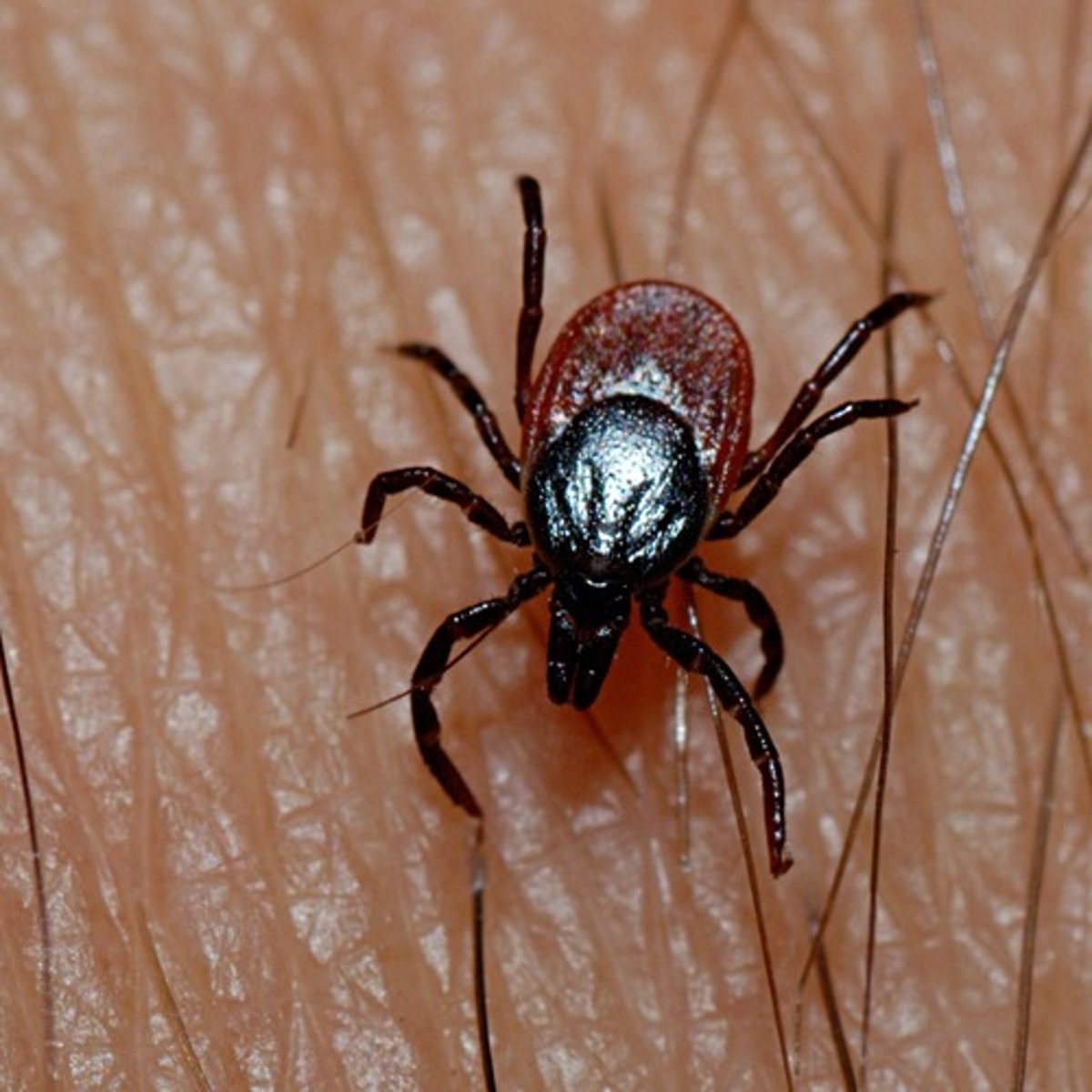 <p>An organism, generally an arthropod, that attaches to or lives on the skin of its host and derives nutrients.</p>