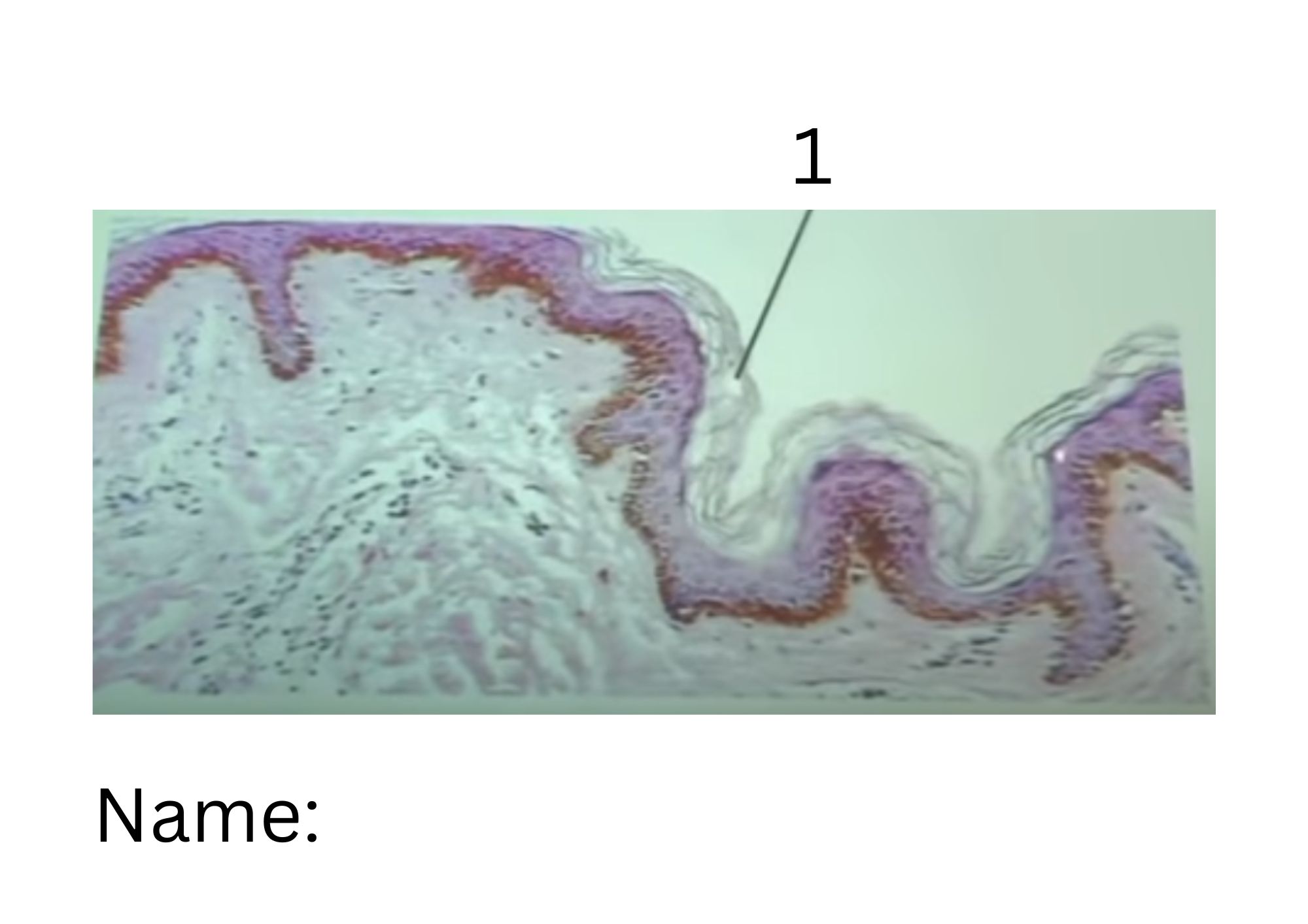 term image
