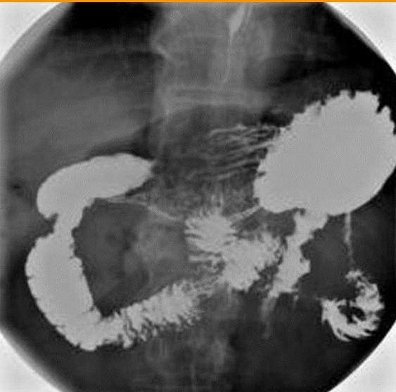 <p>What body habitus is visualized?</p>
