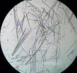 <p>parasitic infection</p>