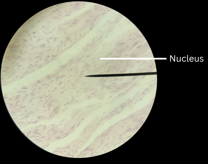 <p>unstriated, involuntary muscles</p>