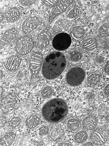 <p>What organelle is this?</p>