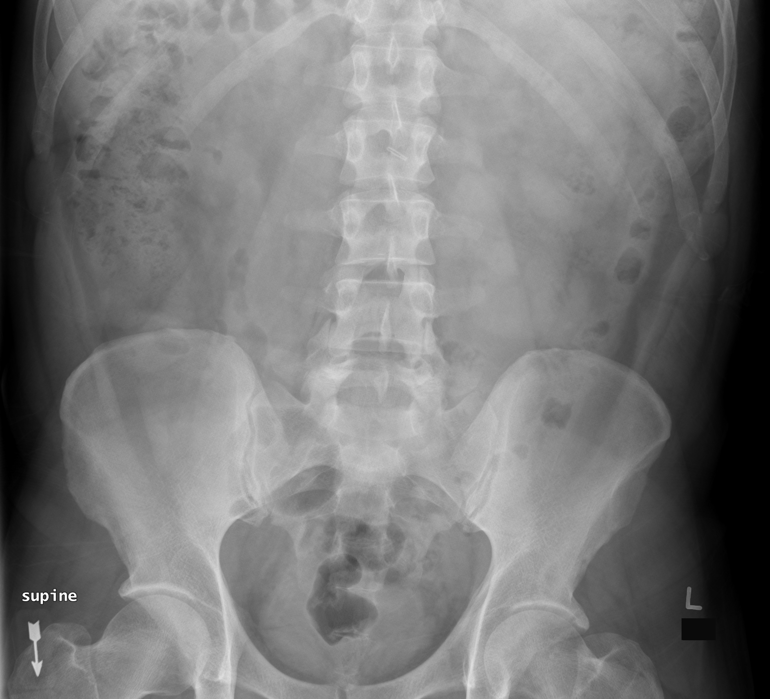 <p>25 y/o a multi-abdomen series. c/o lower abdomen pain. The req states "? hernia". Assess the structures included?</p>