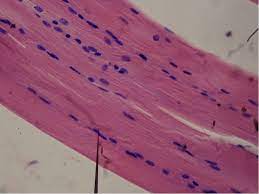 <p>Smooth Muscle</p>
