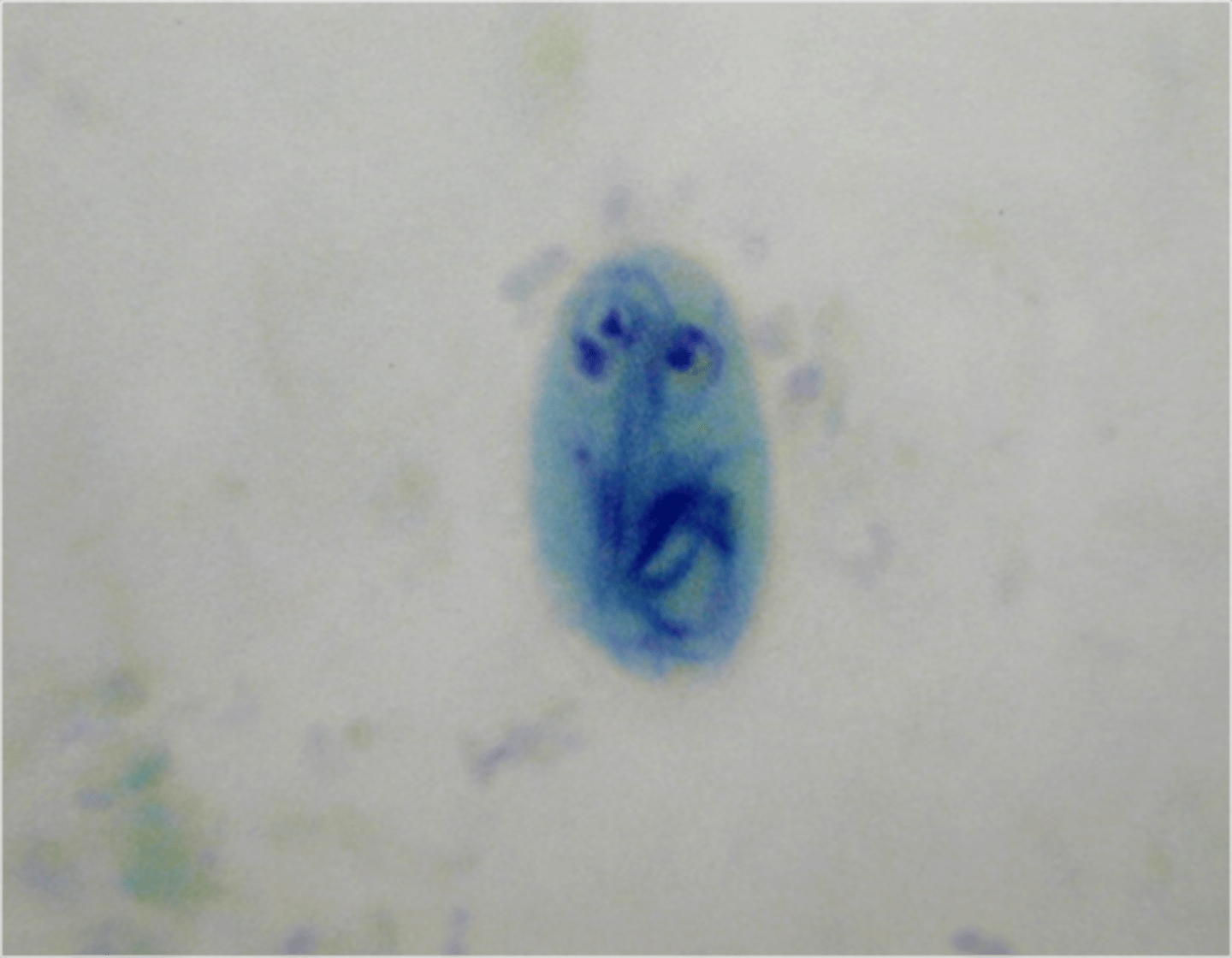 <p>*no flagella, you can see them developing inside<br>*4 nuclei</p>