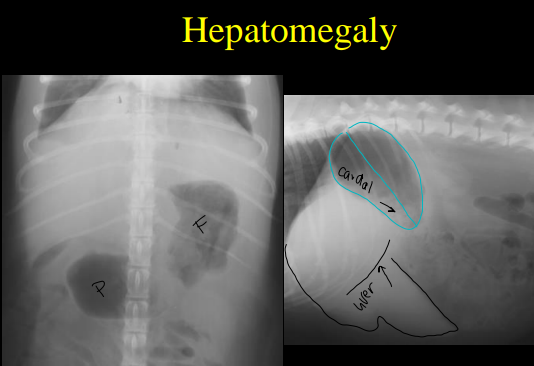 <ul><li><p><strong>Microhepatia</strong></p><ul><li><p><strong>small</strong> size: not at ribs</p></li><li><p><strong>stomach axis: cranially deviated</strong></p></li><li><p><strong>DDX.</strong></p><ul><li><p>normal: deep chested breeds</p></li><li><p>Young <span style="font-size: 14.08px">abnormal</span>: Portosystemic shunt, hepatic microvascular dysplasia</p></li><li><p>Old abnormal: cirrhosis</p></li></ul></li></ul></li><li><p><strong>Hepatomegaly: older dogs</strong></p><ul><li><p><strong>Large</strong> size</p></li><li><p><strong>infiltrative dx: cushings</strong></p><ul><li><p><strong>Focal</strong></p><ul><li><p><strong>Neoplastic:</strong> Hemangiosarcoma, Adenocarcnima, Lymphosarcoma</p></li><li><p><strong>Benign:</strong> Hepatoma, Nodular regen, Cyst, Abscess, Hematoma</p></li></ul></li><li><p><strong>Diffuse</strong></p><ul><li><p><strong>Neoplastic:</strong> Lymphoma, Mast cell</p></li><li><p><strong>Benign:</strong> Nodular regeneration, Hepatic lipidosis, Steroid hepatopathy, Vacuolar degeneration</p></li></ul></li></ul></li></ul></li><li><p><strong>Mineralization</strong></p><ul><li><p>prior flukes, abcesses</p></li></ul></li><li><p><strong>Hepatic Gas: rare</strong></p><ul><li><p>bacti infection</p><p></p><p><br></p></li></ul></li></ul><p></p>