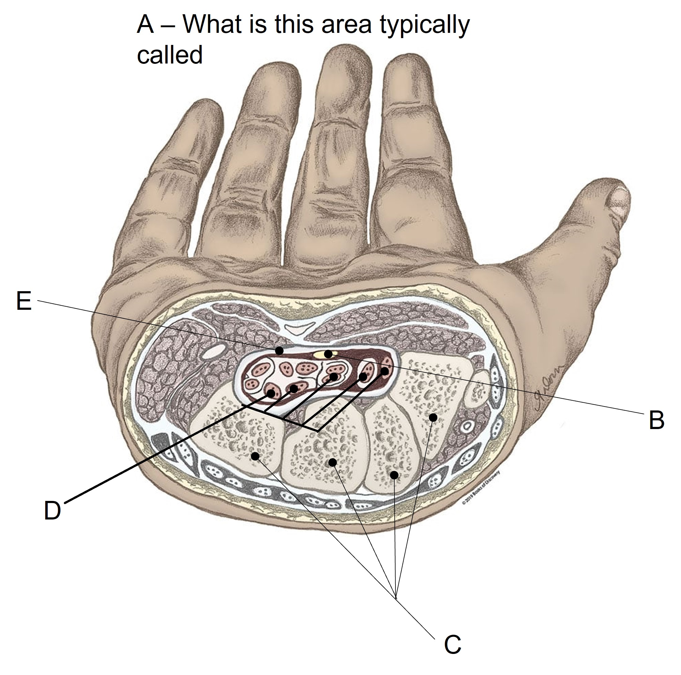 <p>Match the appropriate term with the landmark or structure identified in the picture below. Answers are used once and there are incorrect choices.</p><p></p>