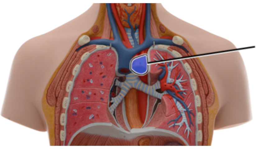 <p><span style="font-family: Arial; font-size: 11px; color: rgb(0, 0, 0);">Name this structure of the heart.</span></p>