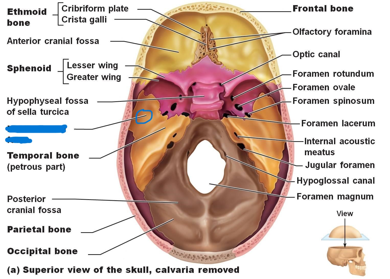 <p>What part of skull?</p>
