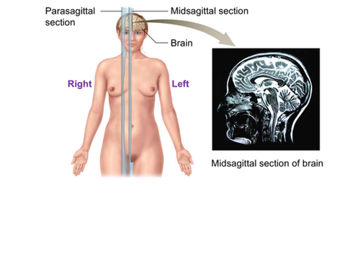 <p>The ______________________ plane (also called the median plane) divides the body into equal left and right sections.</p><p>A) Frontal</p><p>B) Transverse</p><p>C) Midsagittal</p><p>D) Coronal</p>
