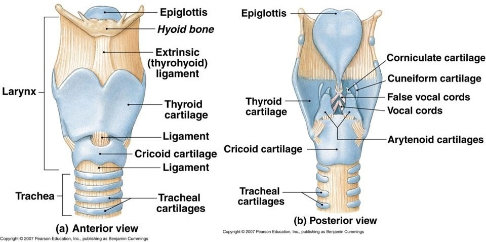<p>T/F The cricoid cartilage</p><p><strong>T -</strong> A. has an anterior arch which moves upwards and backwards due to the contraction of the cricothyroid muscle</p><ul><li><p>cricothyroid muscle tilts the <strong>thyroid cartilage</strong> forward - causes the <strong>anterior arch of the cricoid cartilage</strong> to move <strong>upwards and backwards</strong></p></li></ul><p><strong>T -</strong> B. lengthens the vocal fold (true vocal cord) when its anterior part moves upwards and backwards</p><p><strong>F -</strong> C. has the vocal folds attached to it</p><ul><li><p>serves as a foundation for the laryngeal framework - does not <strong>directly</strong> attach to the vocal folds.</p></li><li><p><strong>vocal folds (true vocal cords)</strong> are attached to:</p><ul><li><p class=""><strong>Anteriorly</strong>: The <strong>thyroid cartilage</strong></p></li><li><p class=""><strong>Posteriorly</strong>: The <strong>vocal processes of the arytenoid cartilages</strong></p></li></ul></li></ul><p><strong>T -</strong> D. gives attachment to the inferior constrictor muscle of the pharynx</p><ul><li><p>specifically to its <strong>lateral aspect</strong></p></li></ul><p><strong>F -</strong> E. is at the level of the fourth cervical vertebra.</p><ul><li><p>located at the <strong>C6 vertebral level</strong></p></li></ul><p></p>