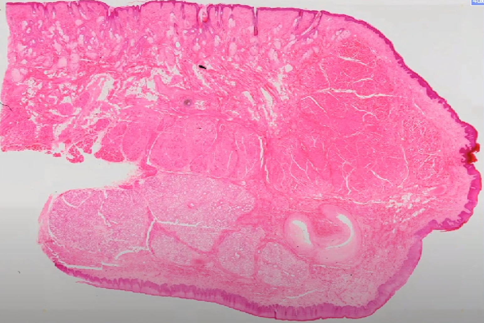 <p>Organ?</p>