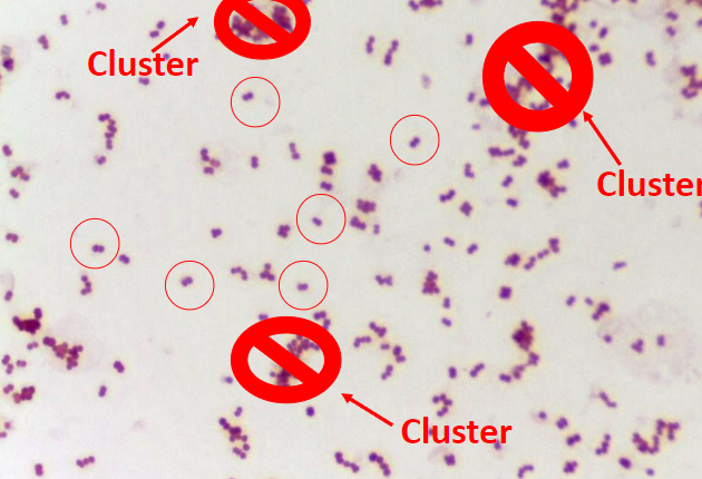 <p>What bacteria is this?</p>