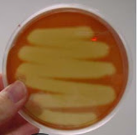 <p>what result on a BAP plate is this</p>