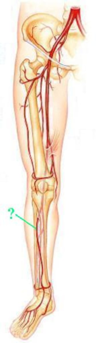 <p>Identify the indicated blood vessel.</p>