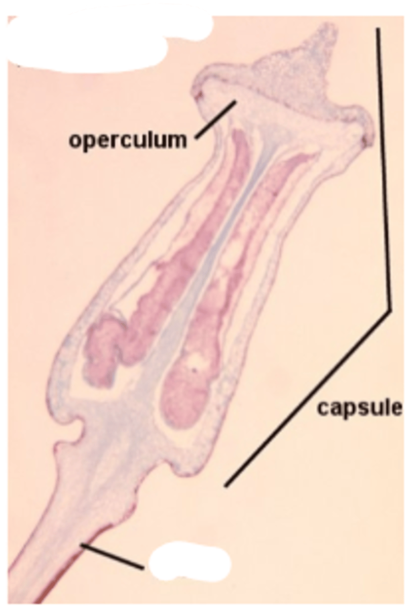 <p>Name the blank REPRODUCTIVE STRUCTURE</p>