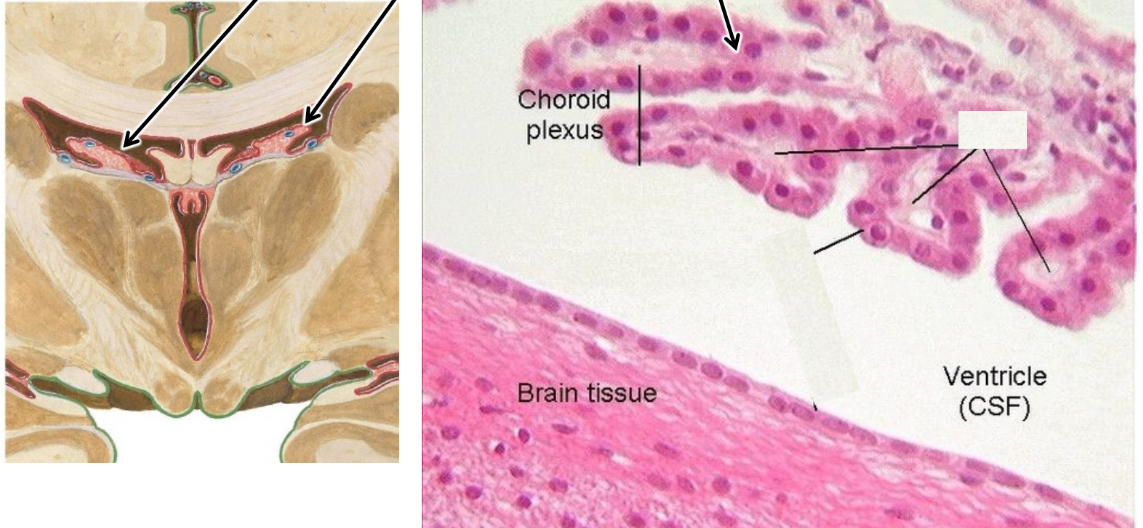 <p>Choroid plexus</p>