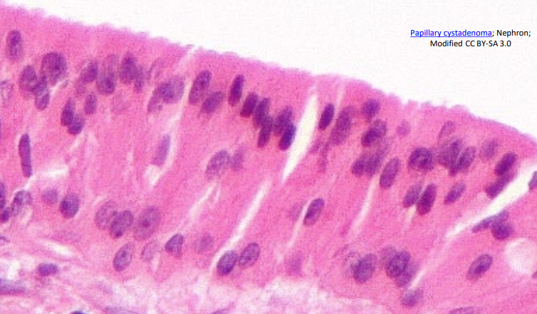 <ul><li><p>Several layers of irregularly shaped cells; only the apical (top) layer is columnar</p></li><li><p>Location: Lines part of the urethra and the excretory ducts of some glands</p></li></ul>